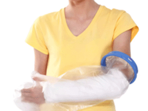 cast cover